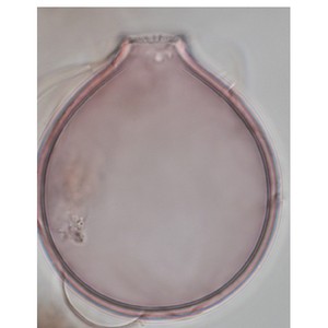 New publication: rethinking how we name fossil ciliates